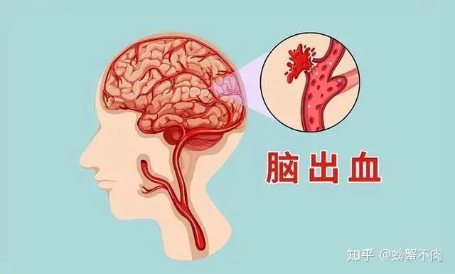 高血压的危害你注意了吗？